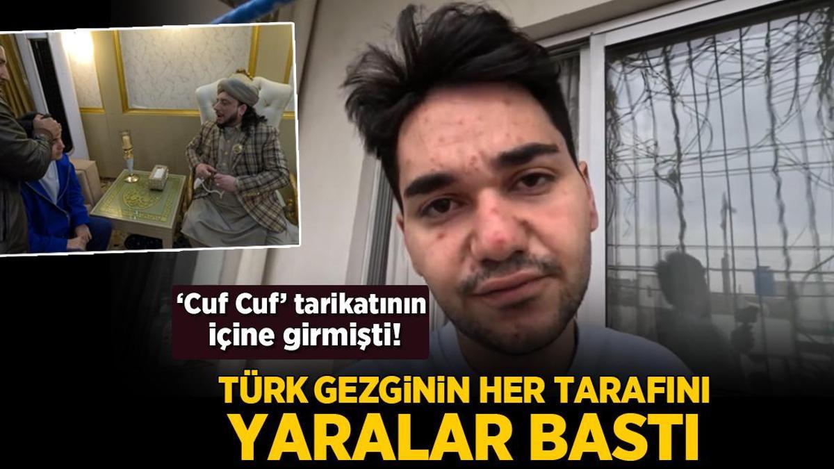 ‘Cuf Cuf’ Tarikatının İçine Giren Türk Gezginin Her Tarafını Yaralar Bastı