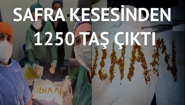 Hasta, safra kesesinden çıkan taşlarla doktorun adını yazdı